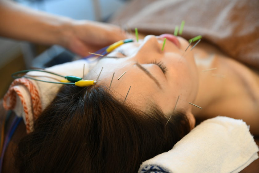 浜松たいかん鍼灸治療院　美容鍼灸画像