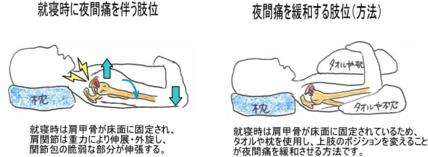 夜間の関節痛にはどうすれば対処できますか?