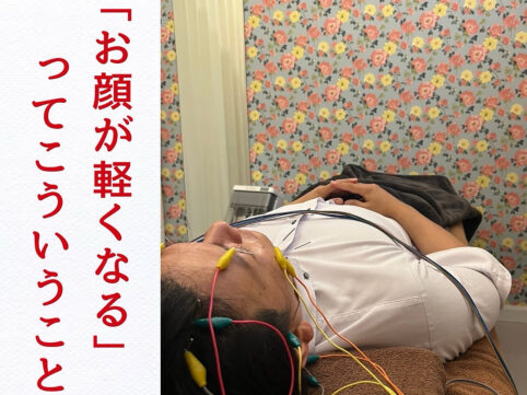 浜松　美容鍼