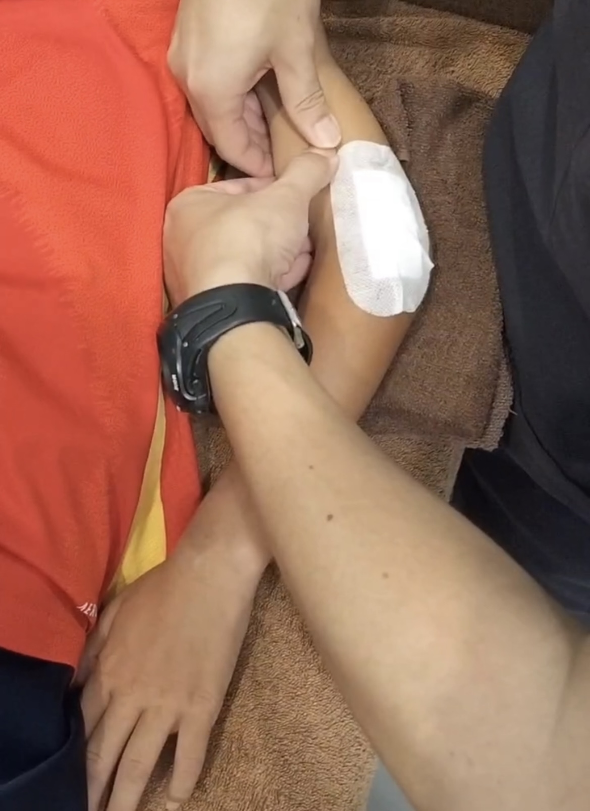 小学生　上腕骨外顆剝離骨折
