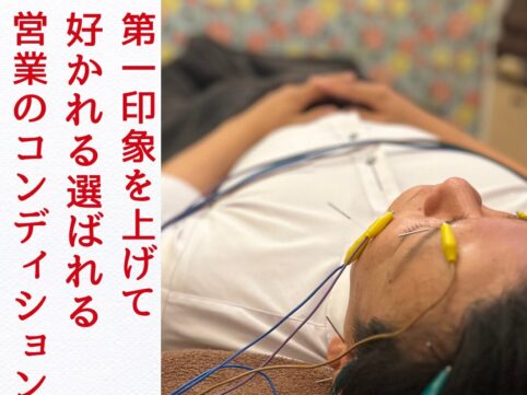 浜松　美容鍼