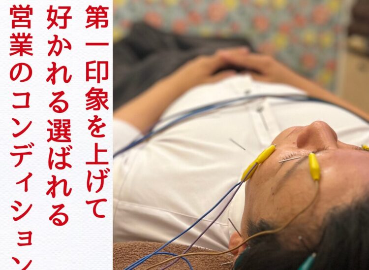 浜松　美容鍼