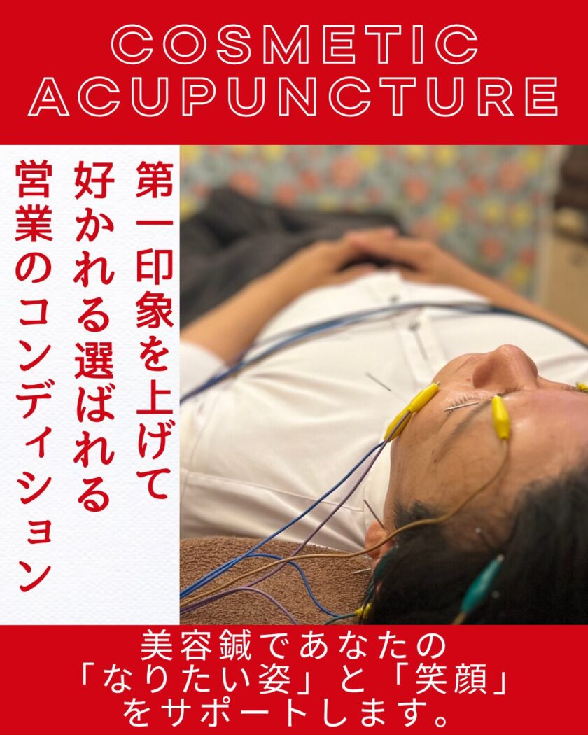 浜松　美容鍼