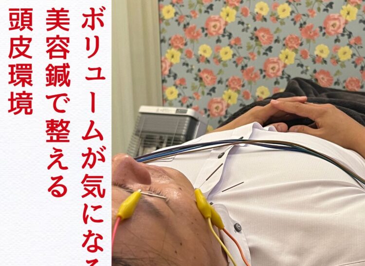 浜松　頭皮ケア　美容鍼
