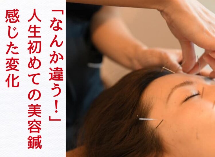浜松　美容鍼