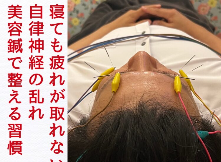 浜松　自律神経ケア　美容鍼