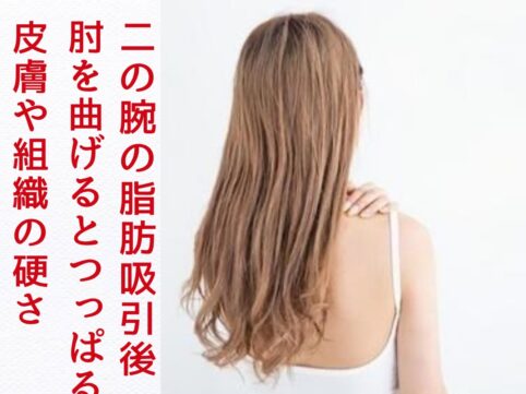 浜松　術後インディバ