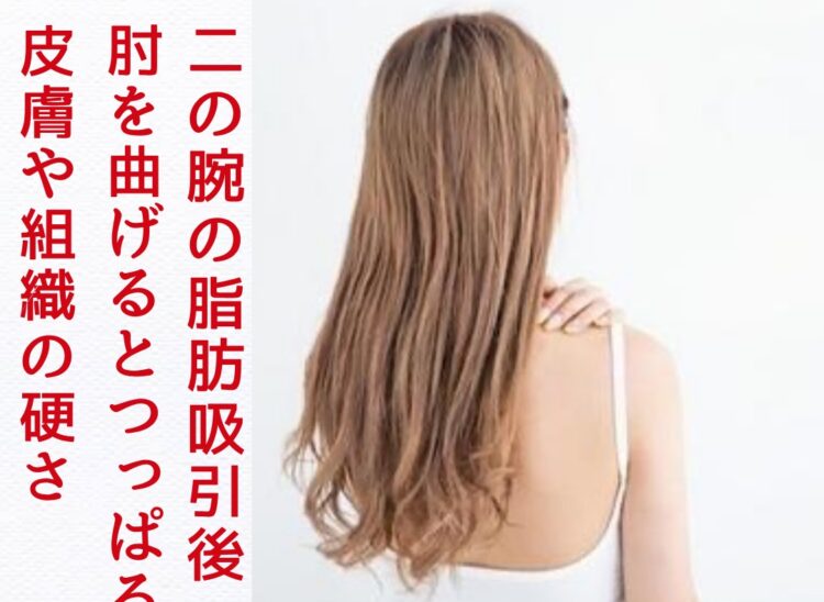 浜松　術後インディバ