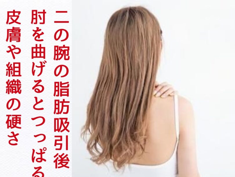 浜松　術後インディバ